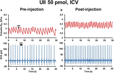 Central and Peripheral Effects of Urotensin II and Urotensin II-Related Peptides on Cardiac Baroreflex Sensitivity in Trout